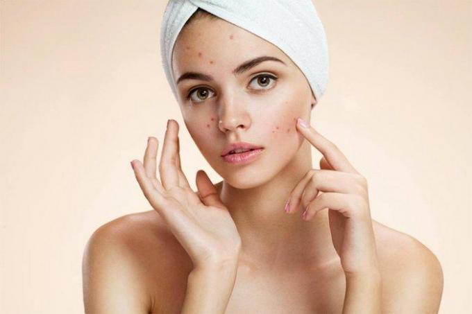 10 sätt att använda bakpulver i stället för de vanliga kosmetiska produkter